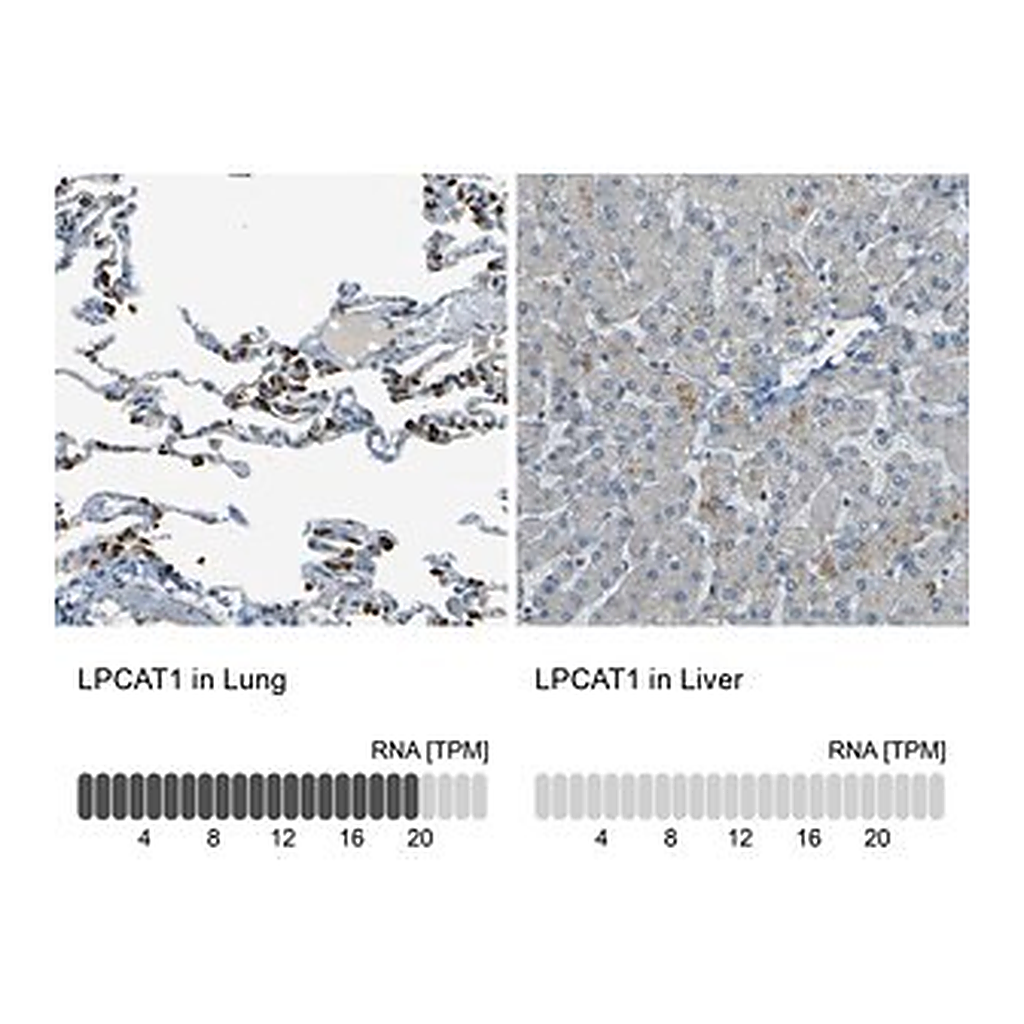 Merck Anti-LPCAT1 antibody produced in rabbit