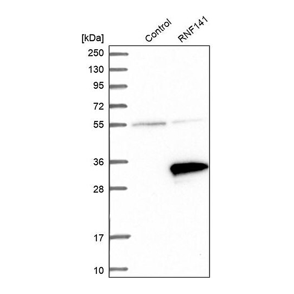 Merck Anti-RNF141 antibody produced in rabbit