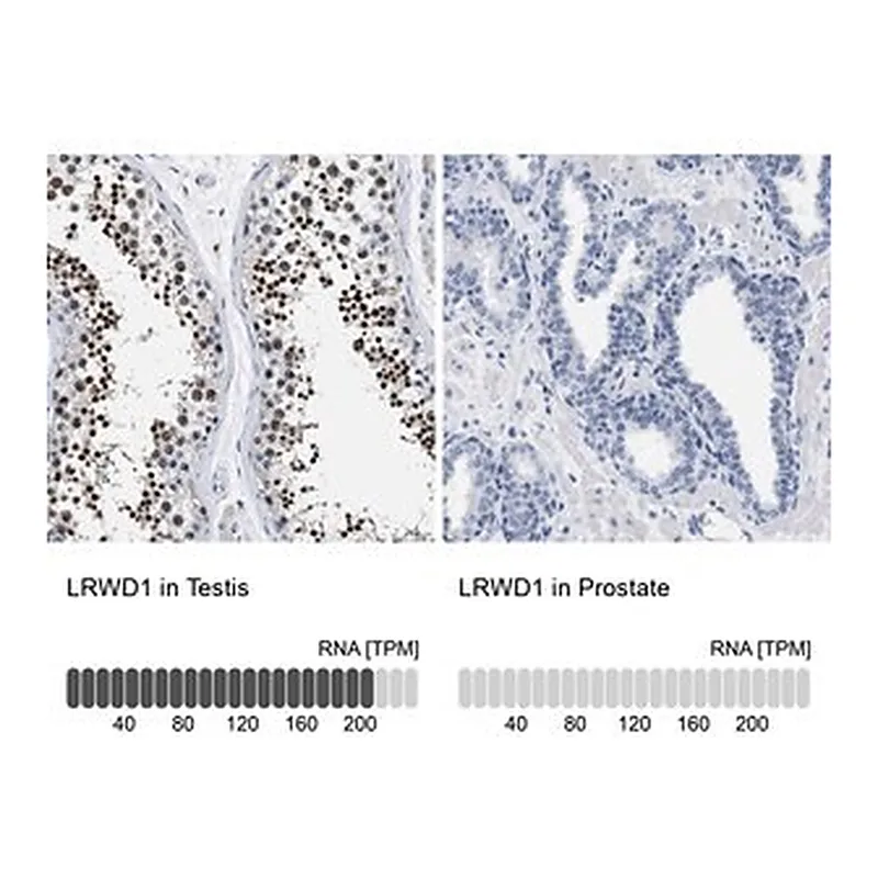 Merck Anti-LRWD1 antibody produced in rabbit