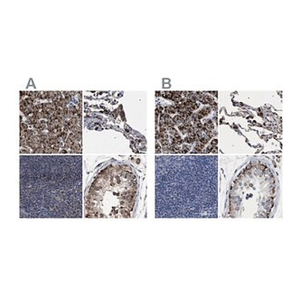 Merck Anti-HSD17B4 antibody produced in rabbit