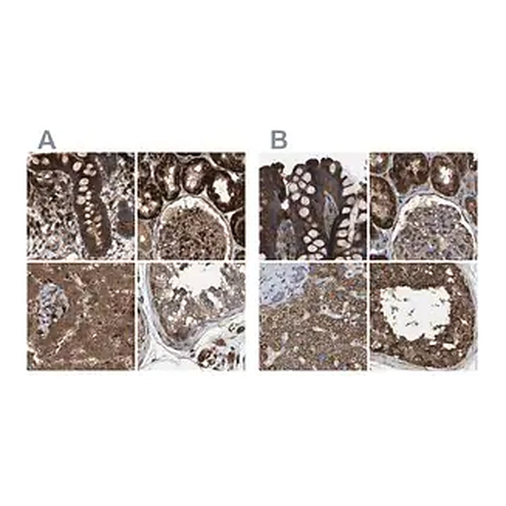Merck Anti-GCC1 antibody produced in rabbit