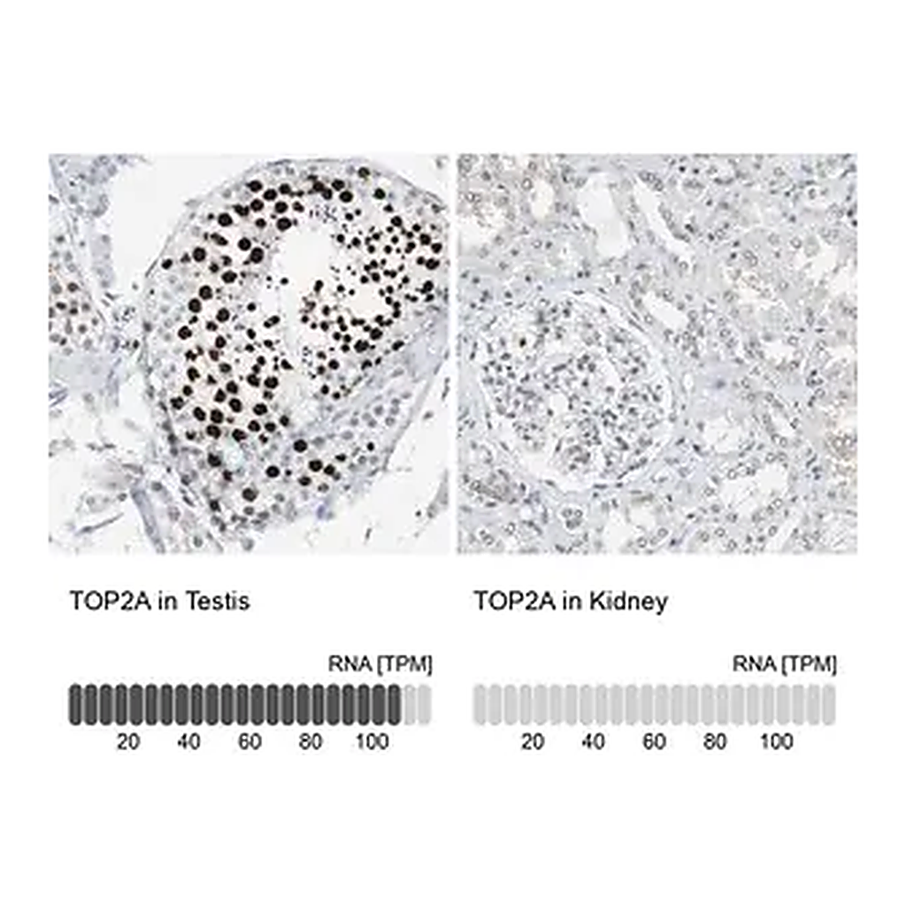 Merck Anti-TOP2A antibody produced in rabbit