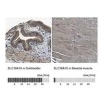 Merck Anti-SLC38A10 antibody produced in rabbit