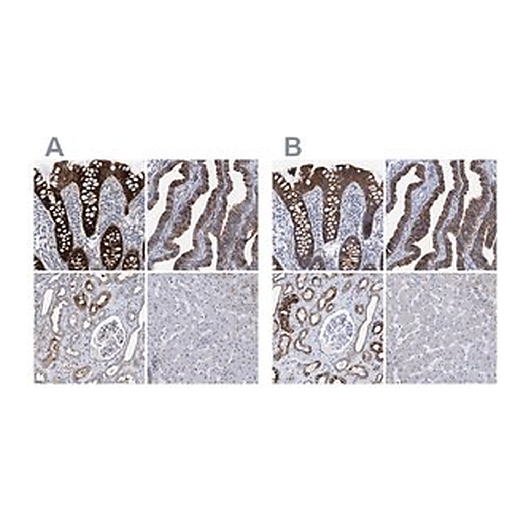 Merck Anti-MKS1 antibody produced in rabbit