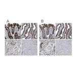 Merck Anti-MKS1 antibody produced in rabbit
