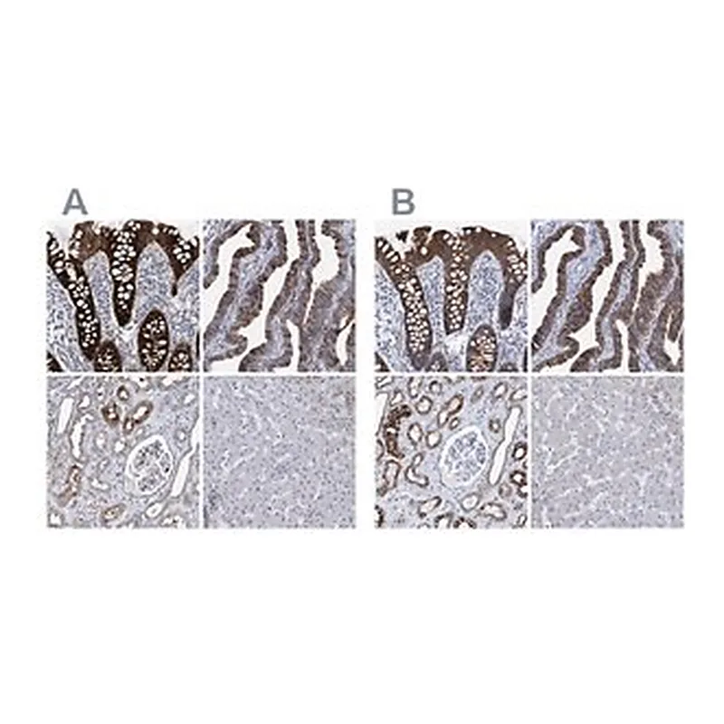 Merck Anti-MKS1 antibody produced in rabbit