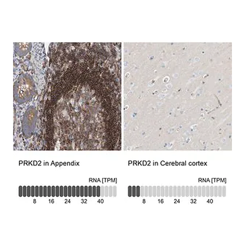 Merck Anti-PRKD2 antibody produced in rabbit