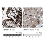 Merck Anti-ZBTB10 antibody produced in rabbit