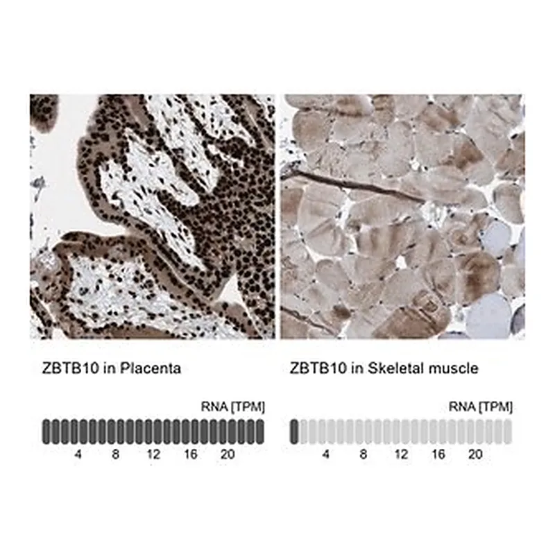Merck Anti-ZBTB10 antibody produced in rabbit