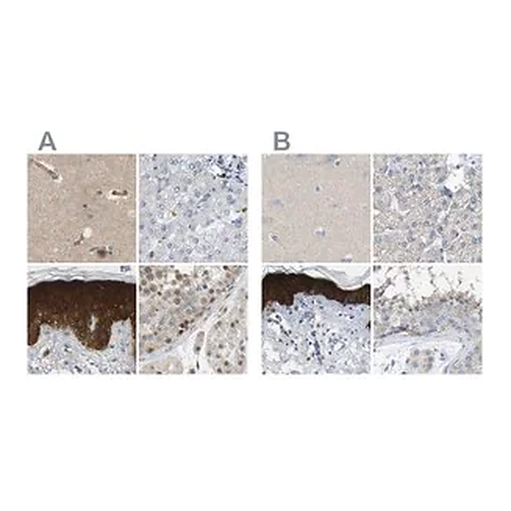 Merck Anti-SERPINB5 antibody produced in rabbit
