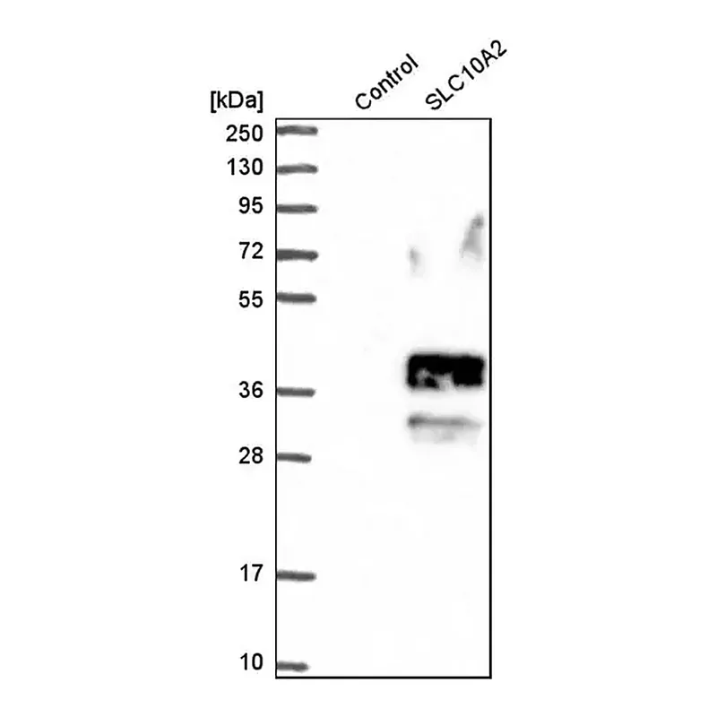 Merck Anti-SLC10A2 antibody produced in rabbit