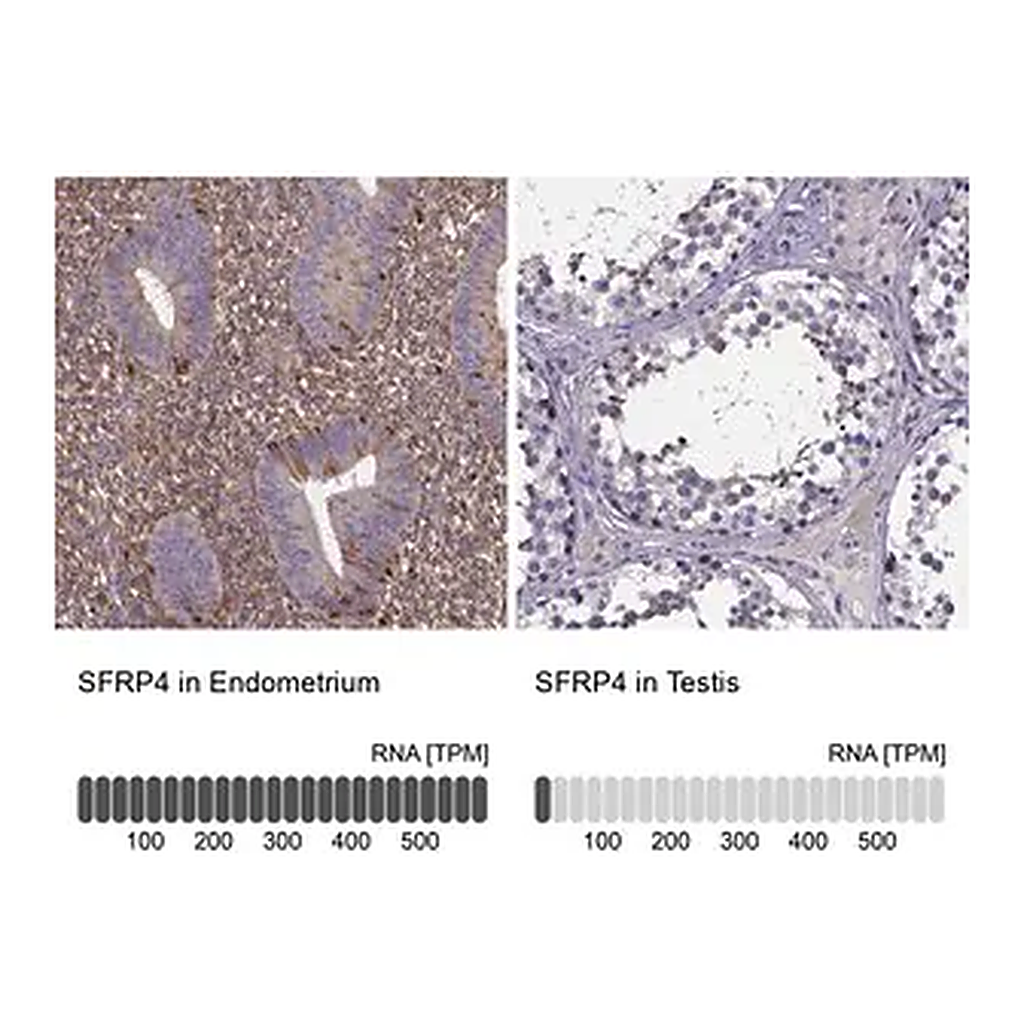 Merck Anti-SFRP4 antibody produced in rabbit