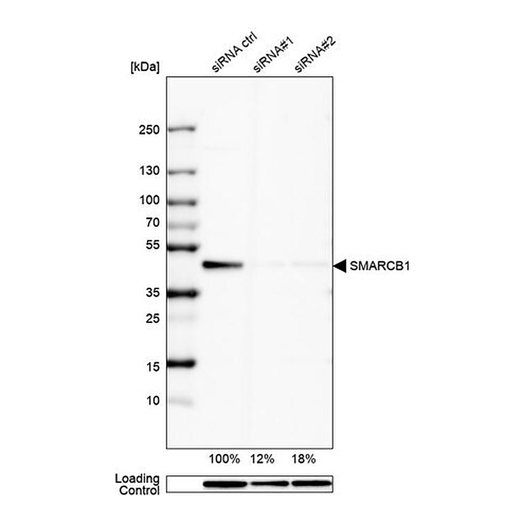 Merck Anti-SMARCB1 antibody produced in rabbit
