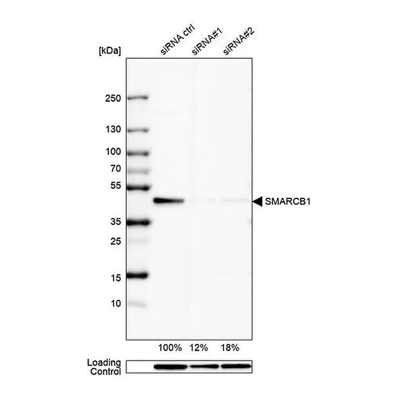Merck Anti-SMARCB1 antibody produced in rabbit