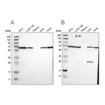 Merck Anti-LTA4H antibody produced in rabbit