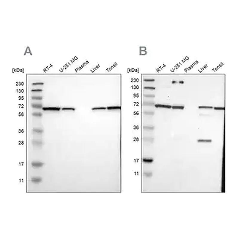 Merck Anti-LTA4H antibody produced in rabbit
