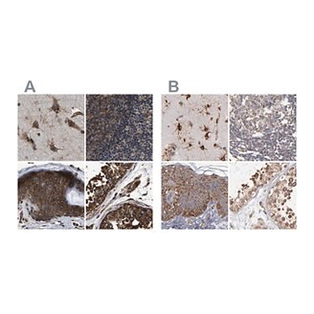 Merck Anti-KTN1 antibody produced in rabbit