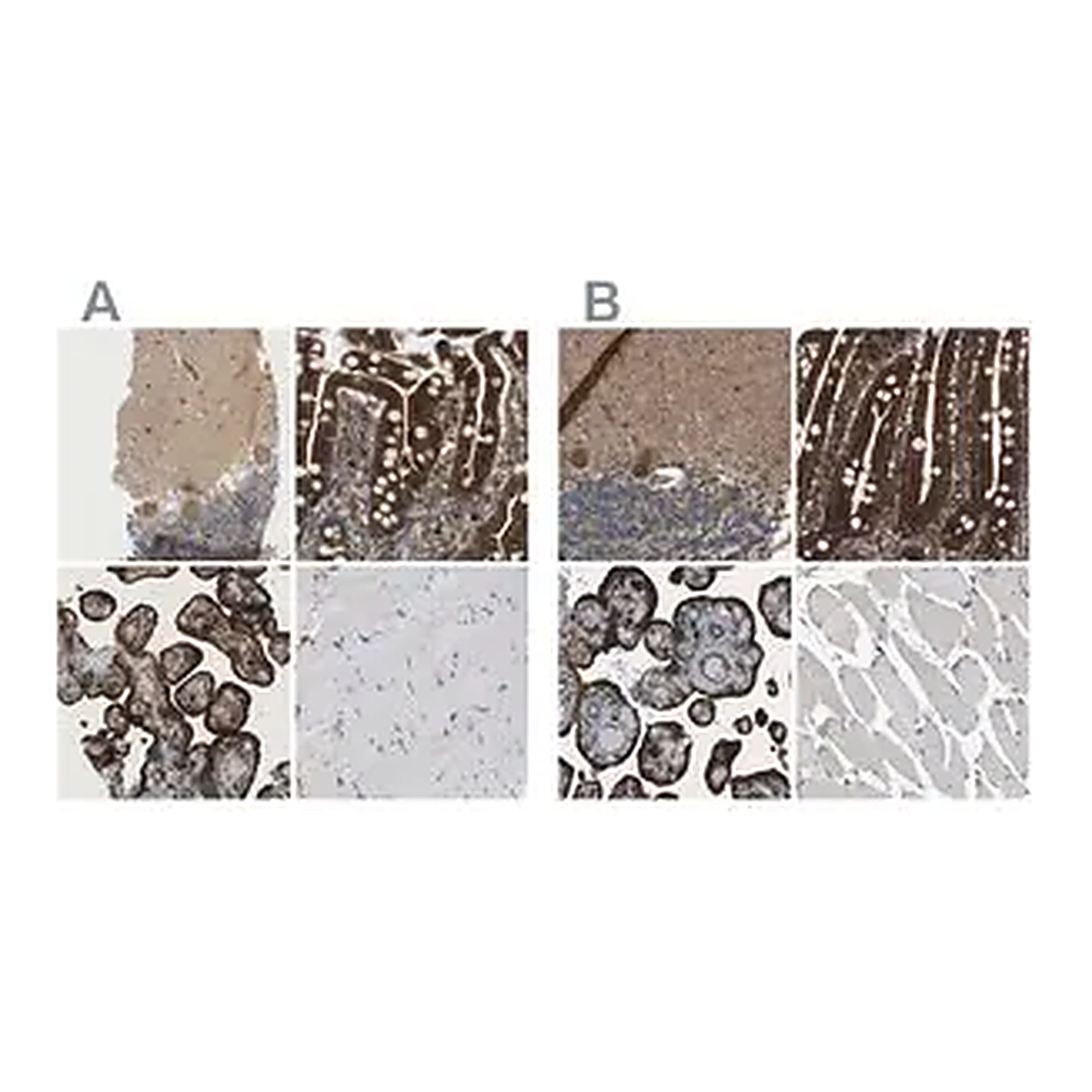 Merck Anti-PICALM antibody produced in rabbit