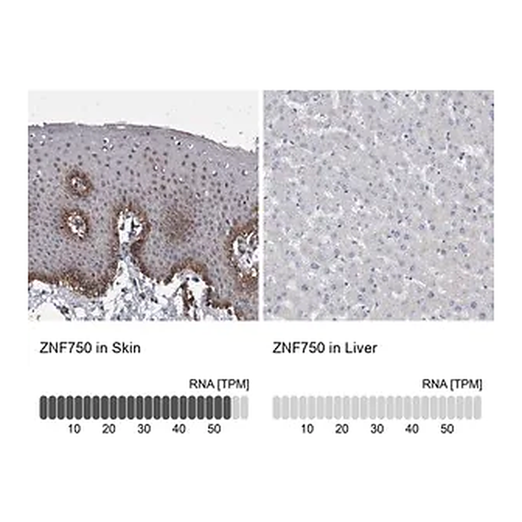 Merck Anti-ZNF750 antibody produced in rabbit