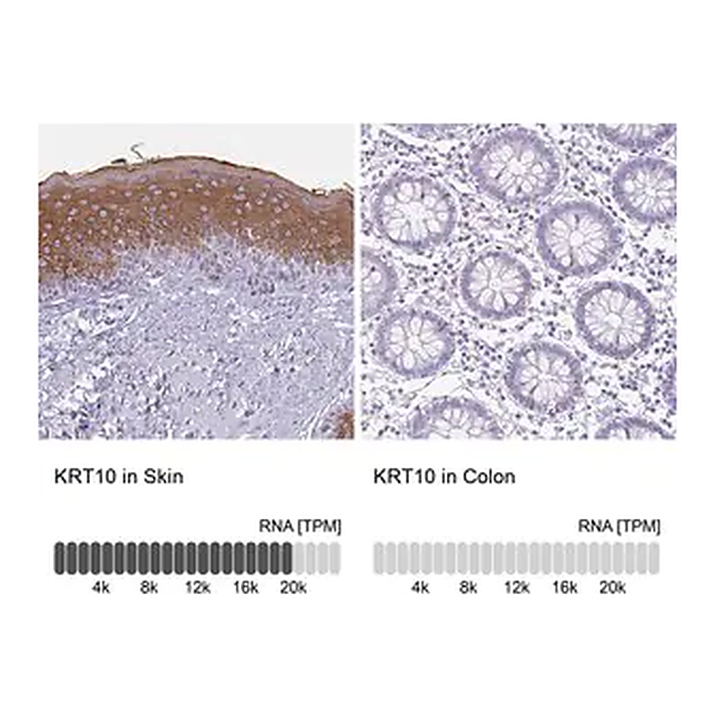 Merck Anti-KRT10 antibody produced in rabbit