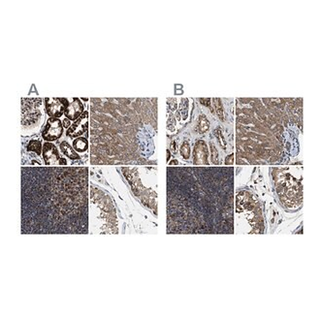 Merck Anti-TACO1 antibody produced in rabbit