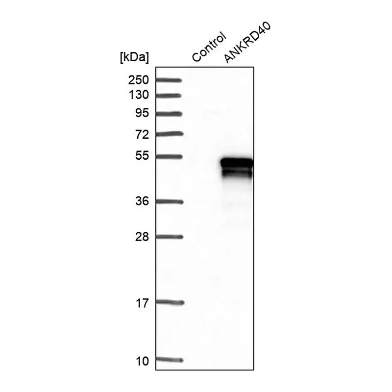 Merck Anti-ANKRD40 antibody produced in rabbit