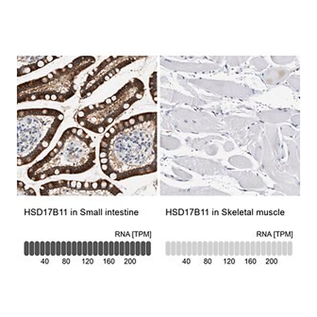 Merck Anti-HSD17B11 antibody produced in rabbit