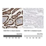 Merck Anti-HSD17B11 antibody produced in rabbit