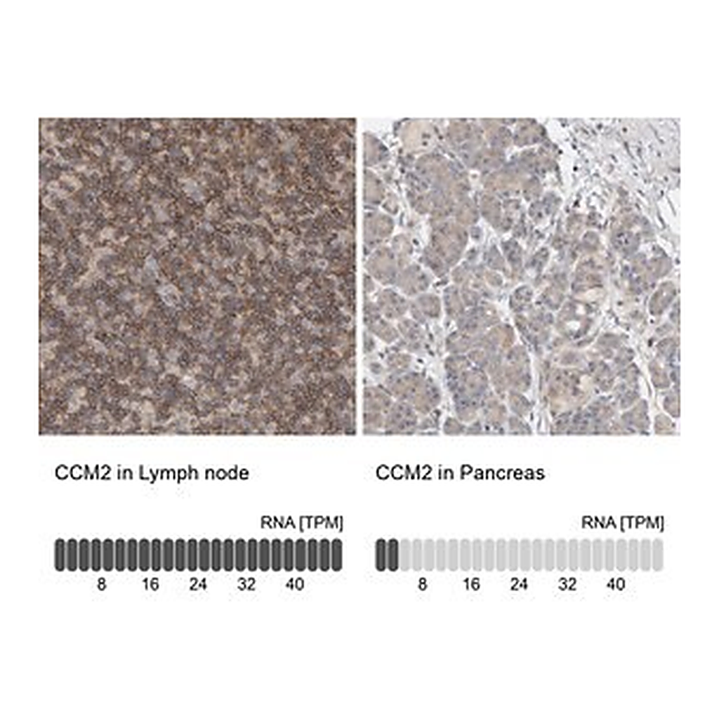 Merck Anti-CCM2 antibody produced in rabbit