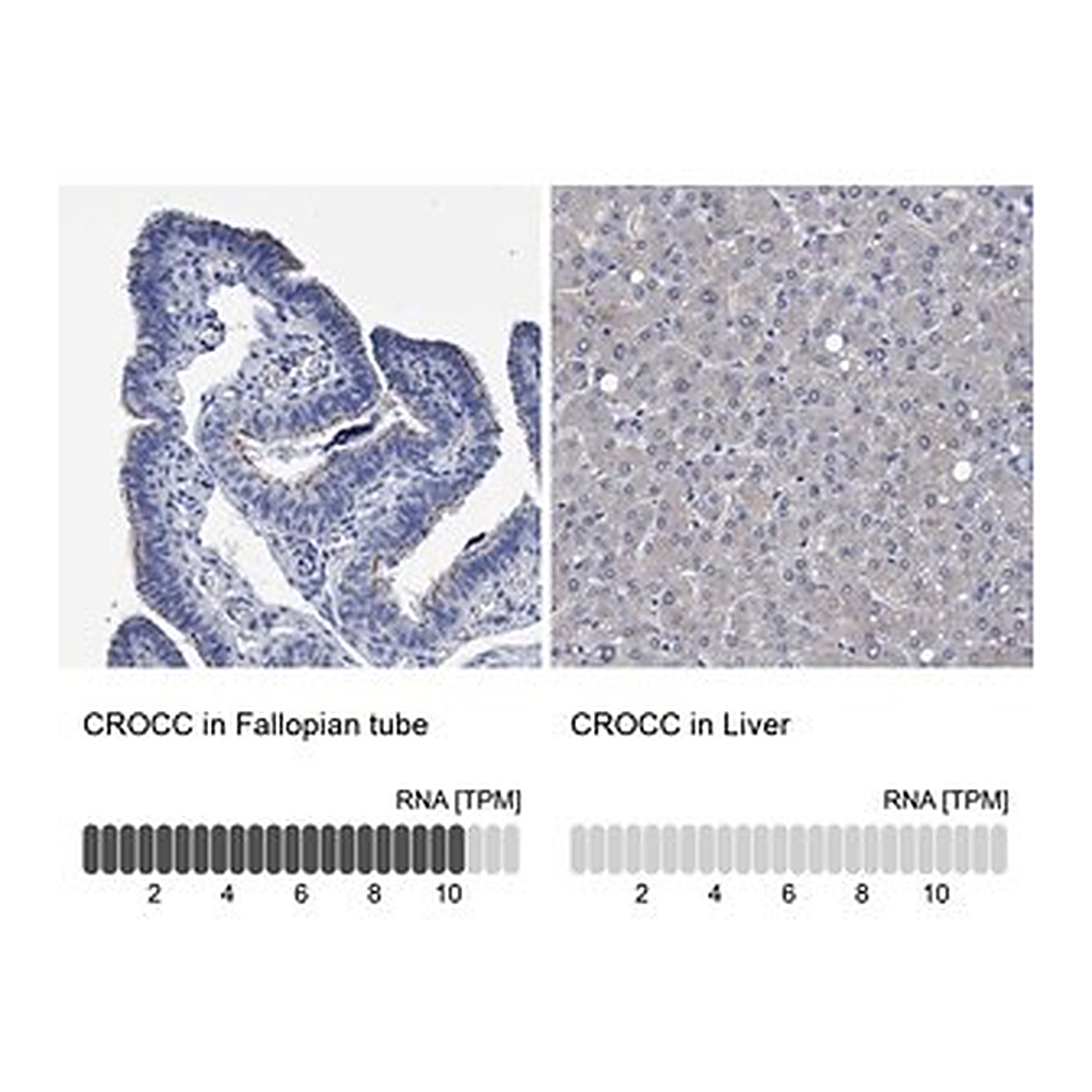 Merck Anti-CROCC antibody produced in rabbit