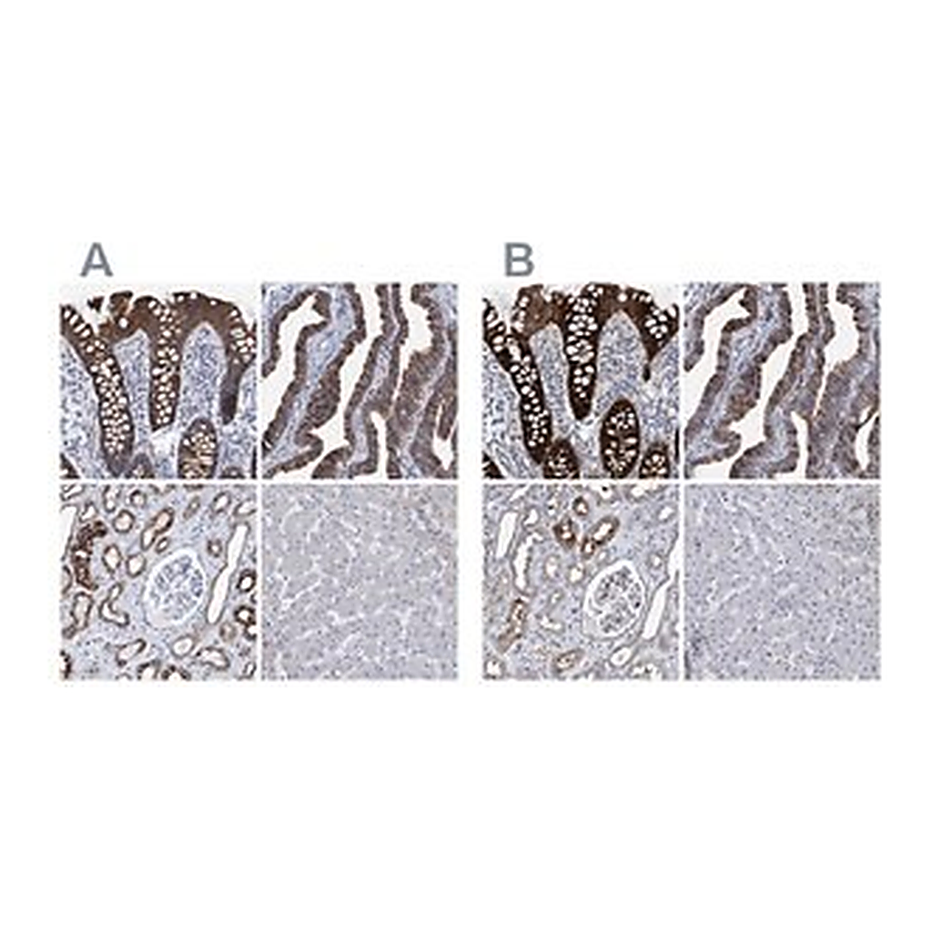 Merck Anti-MKS1 antibody produced in rabbit