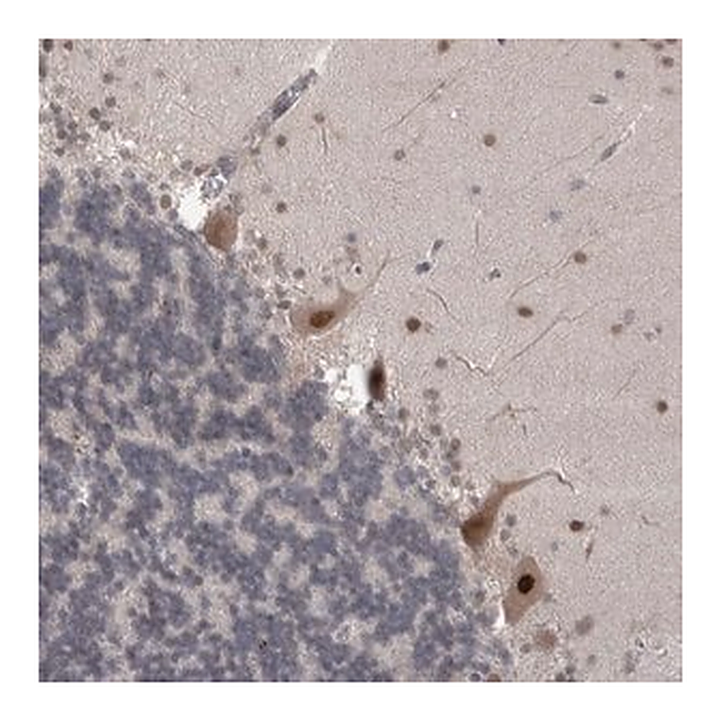 Merck Anti-MTBP antibody produced in rabbit