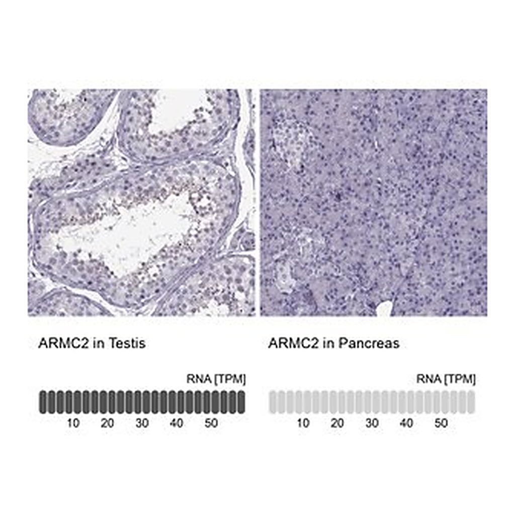 Merck Anti-ARMC2 antibody produced in rabbit