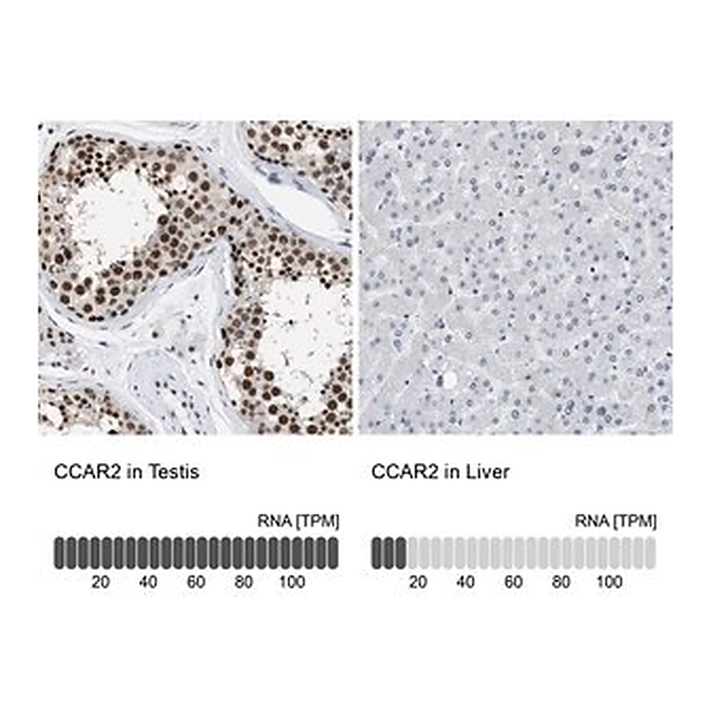 Merck Anti-CCAR2 antibody produced in rabbit