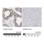 Merck Anti-CCAR2 antibody produced in rabbit