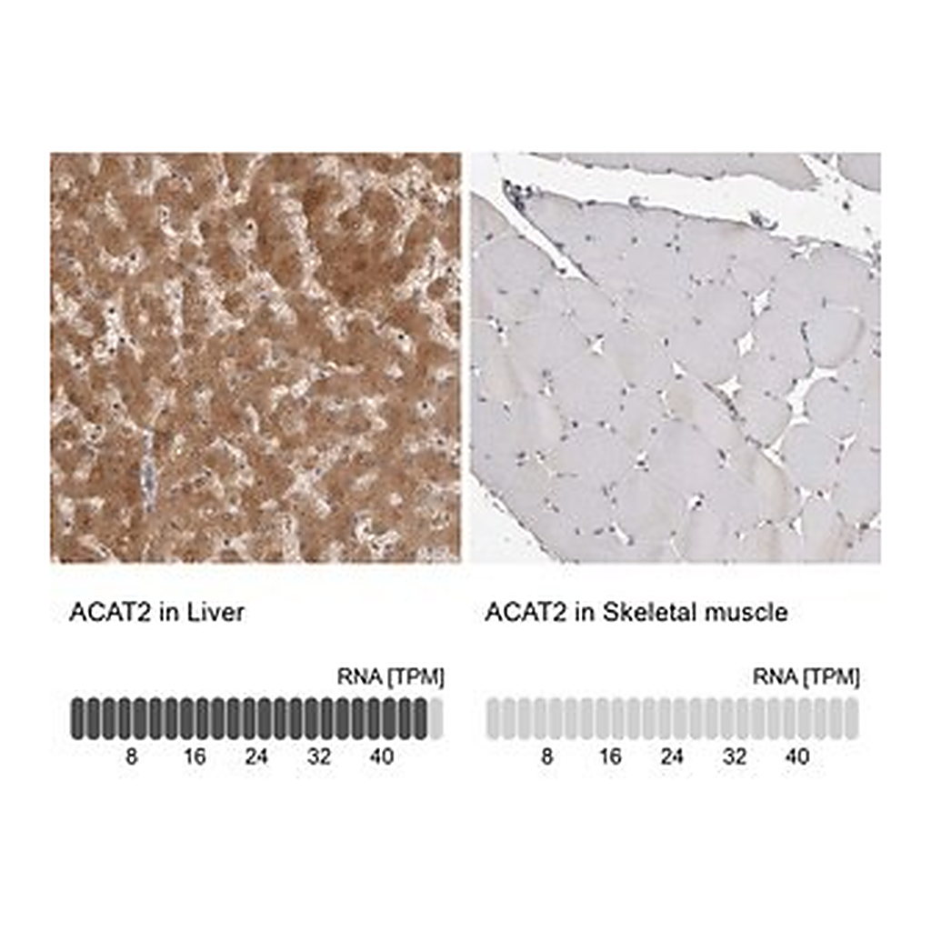 Merck Anti-ACAT2 antibody produced in rabbit