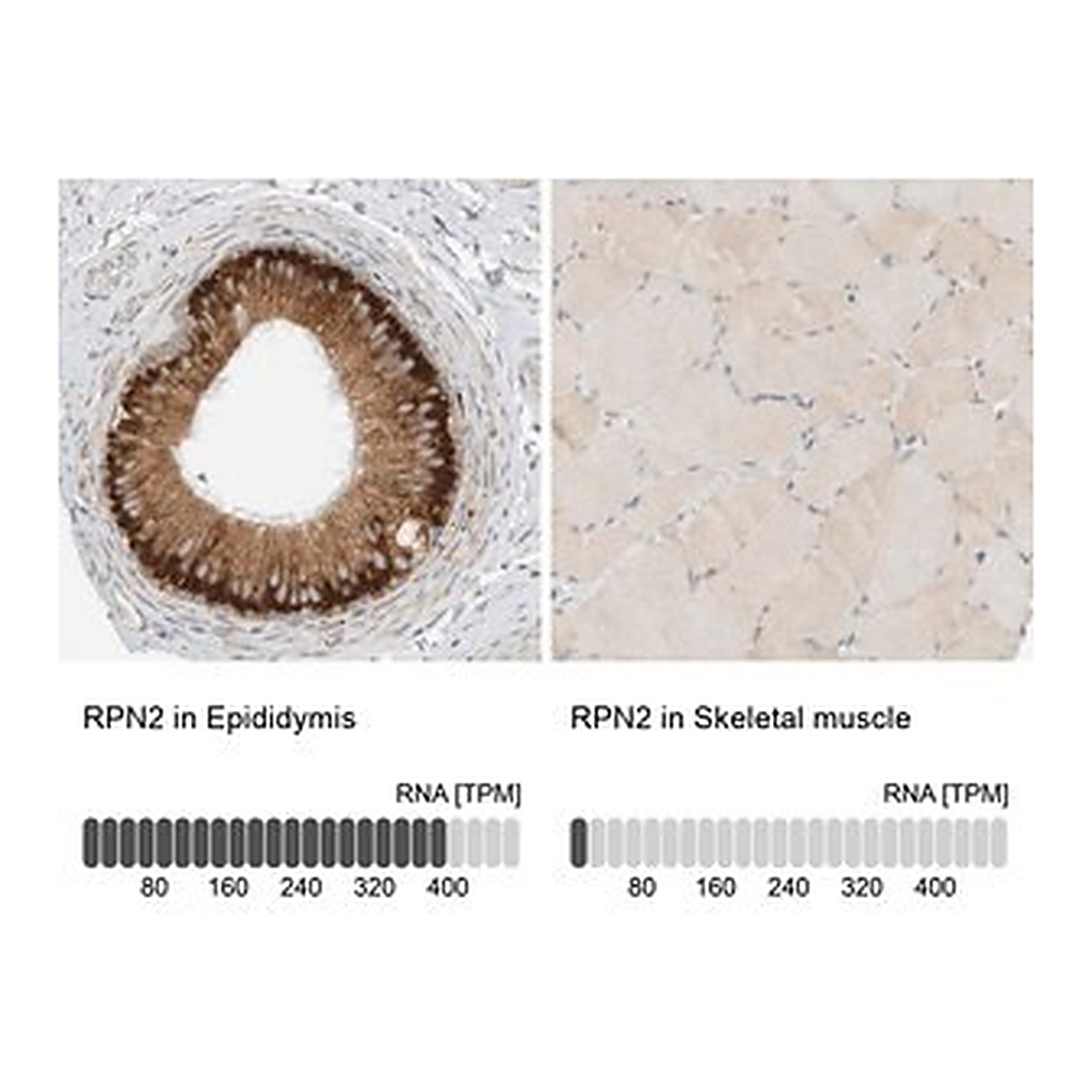 Merck Anti-RPN2 antibody produced in rabbit