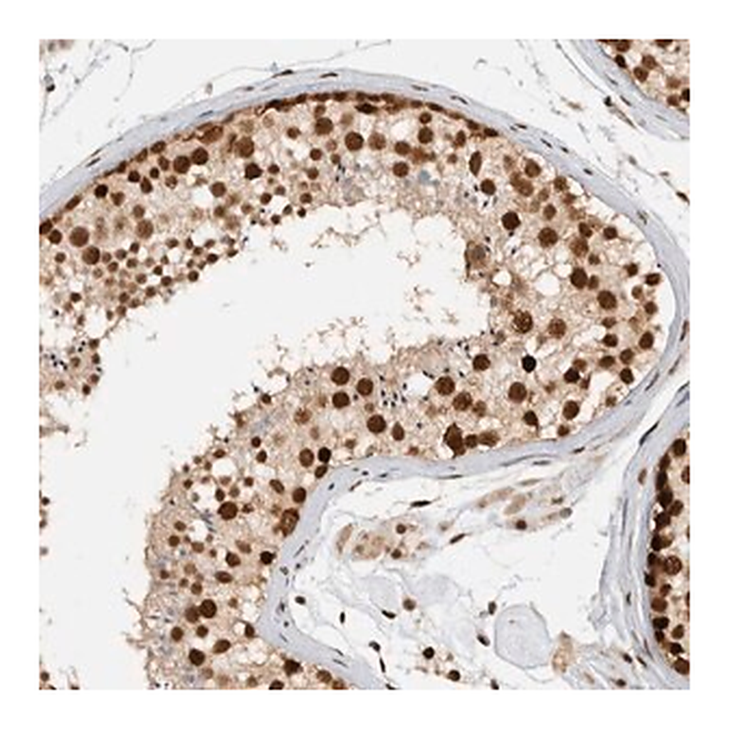 Merck Anti-DDX42 antibody produced in rabbit