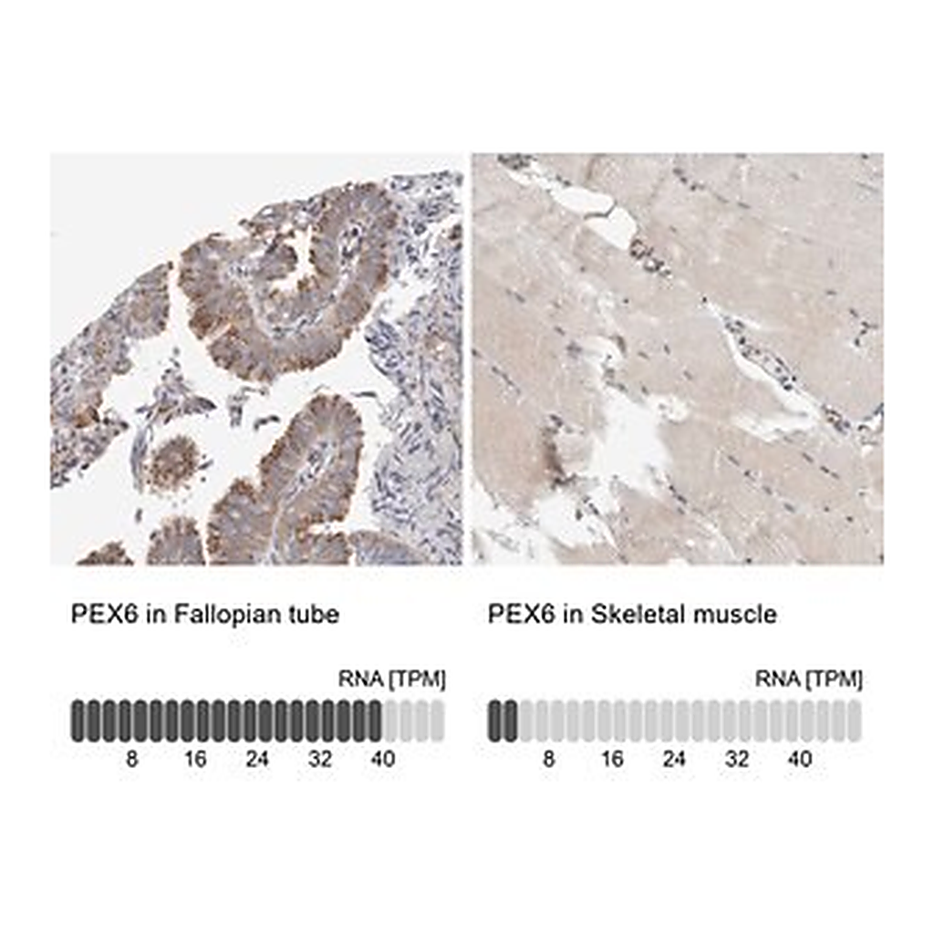 Merck Anti-PEX6 antibody produced in rabbit