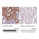 Merck Anti-SLC27A2 antibody produced in rabbit