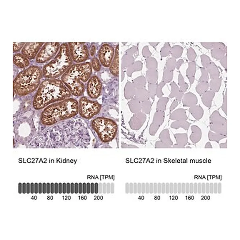Merck Anti-SLC27A2 antibody produced in rabbit