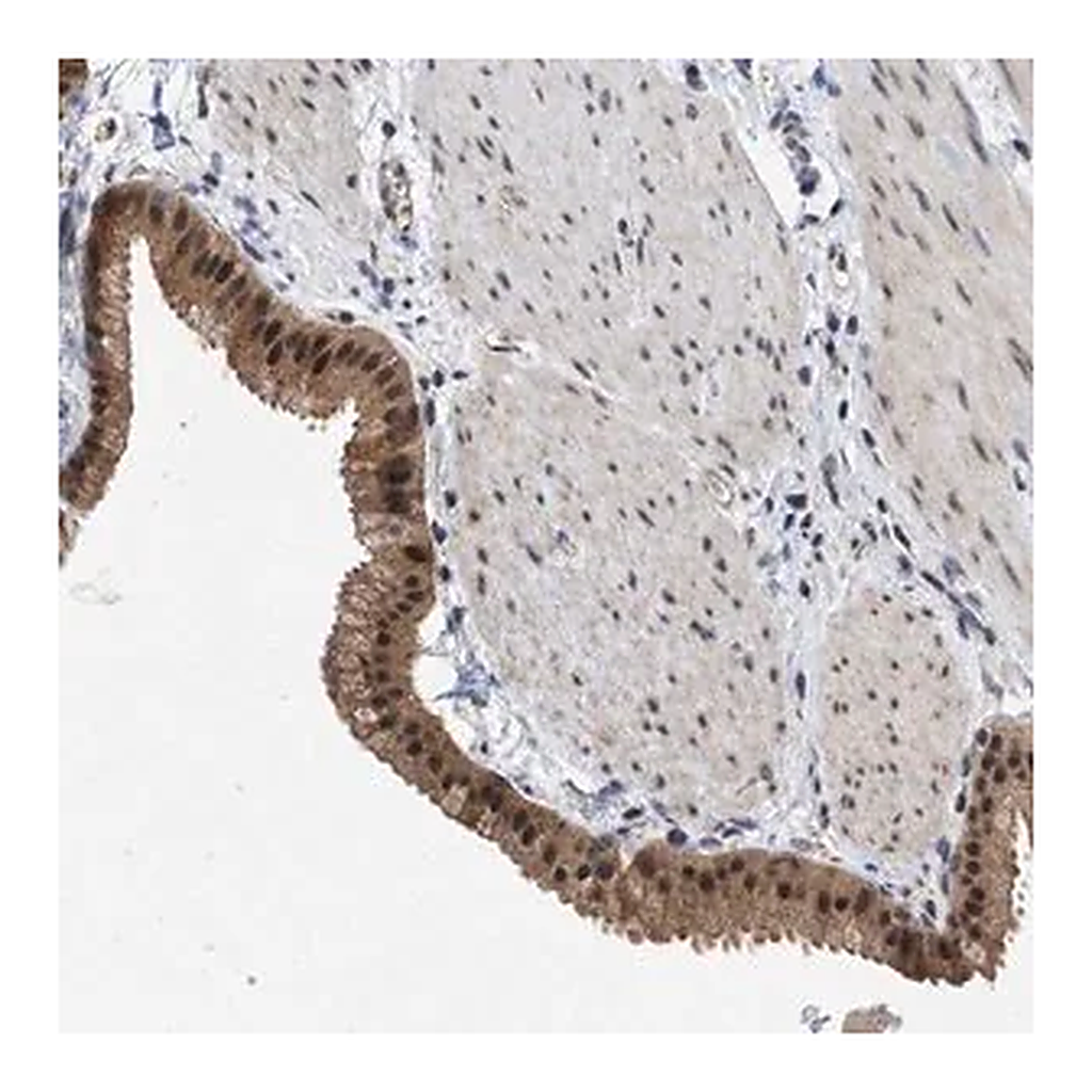 Merck Anti-MKNK2 antibody produced in rabbit