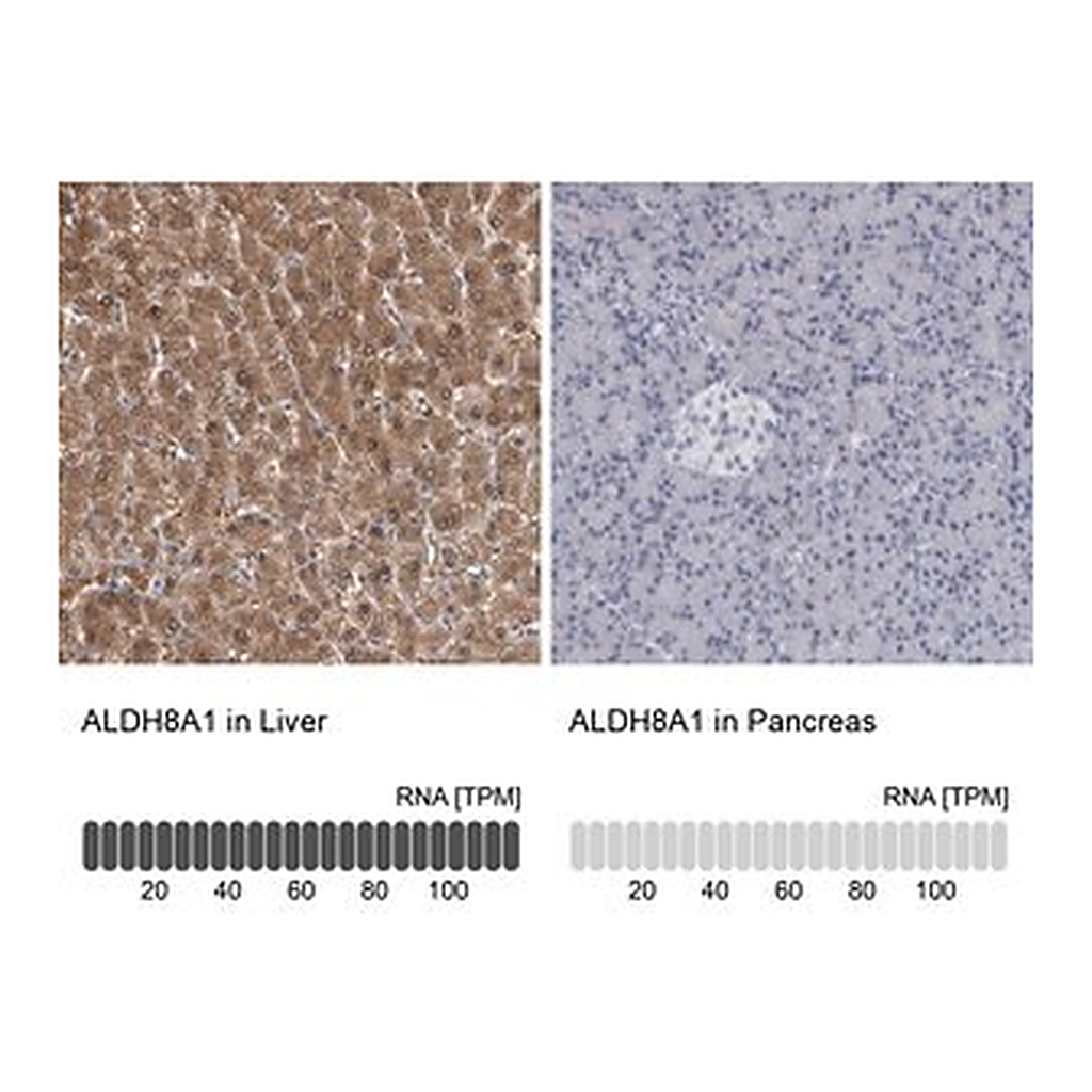 Merck Anti-ALDH8A1 antibody produced in rabbit