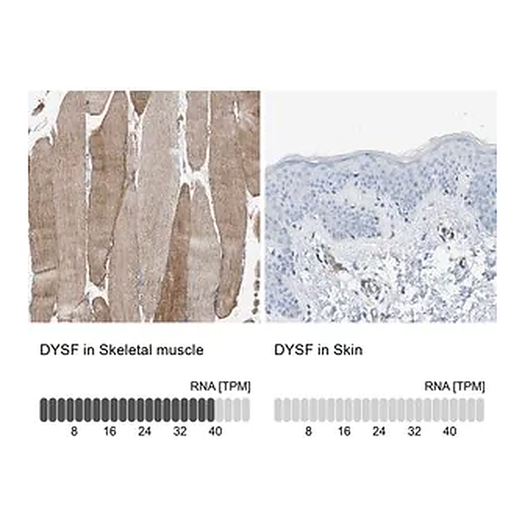 Merck Anti-DYSF antibody produced in rabbit