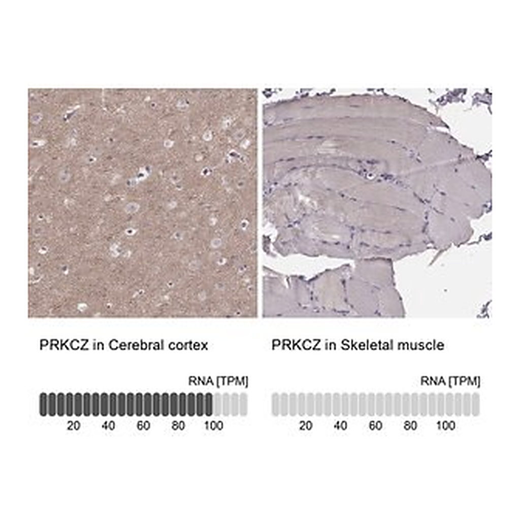 Merck Anti-PRKCZ antibody produced in rabbit
