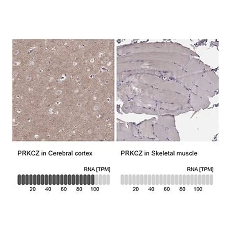Merck Anti-PRKCZ antibody produced in rabbit
