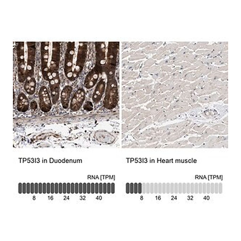 Merck Anti-TP53I3 antibody produced in rabbit