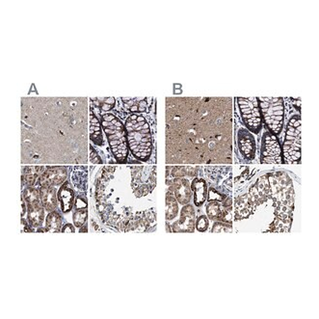 Merck Anti-MECR antibody produced in rabbit