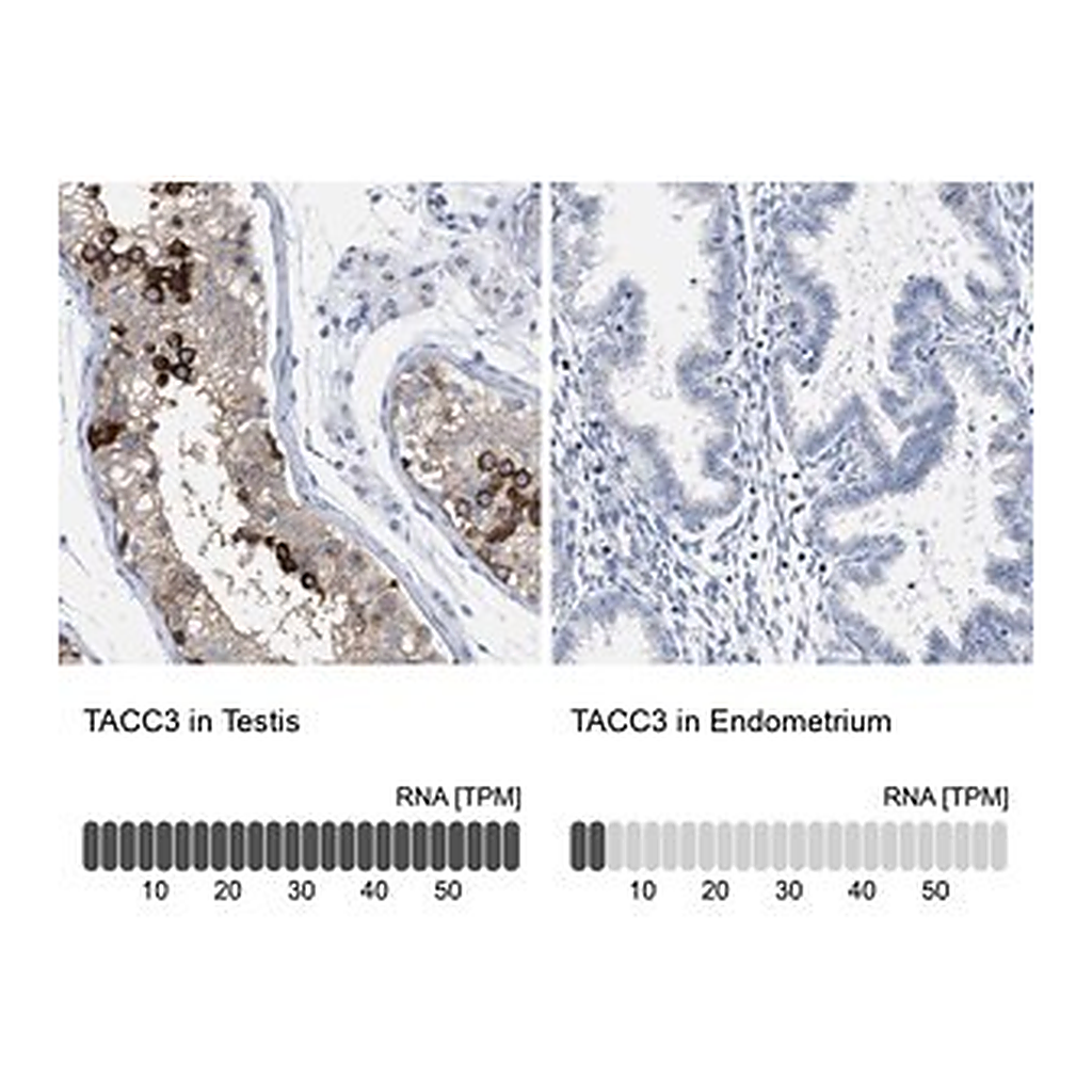 Merck Anti-TACC3 antibody produced in rabbit