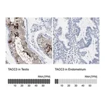 Merck Anti-TACC3 antibody produced in rabbit